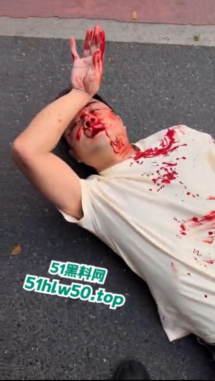 广东潮汕暴躁男在线作死,只因未戴头盔强行躲检撞飞交警双双倒地不起满脸是伤!-3