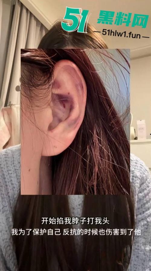 两位抖音百万网红,前CUBA成员【程鑫凯】家暴【鸡腿诺】事件持续发酵,未流出资料曝光完整吃瓜。-40