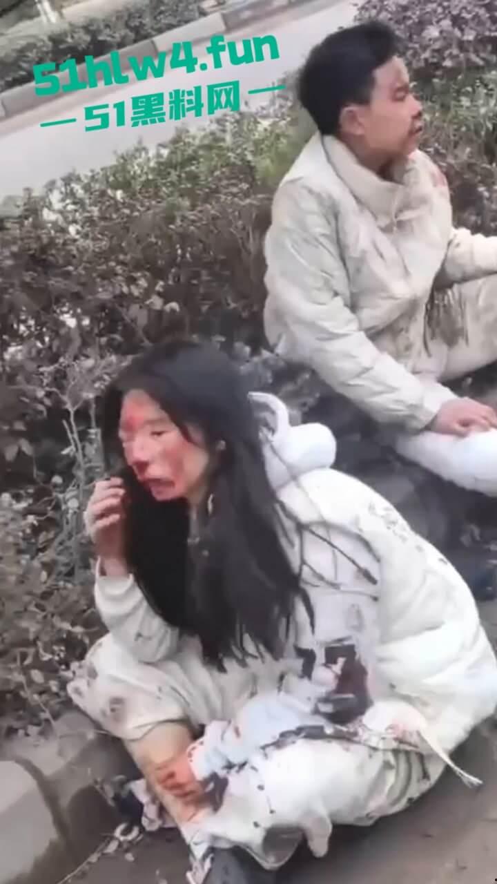 内江资中奇葩车祸五菱宏光加速超车,竟然失控出车祸俩人都变成熊猫脸,看着太搞笑了。-8