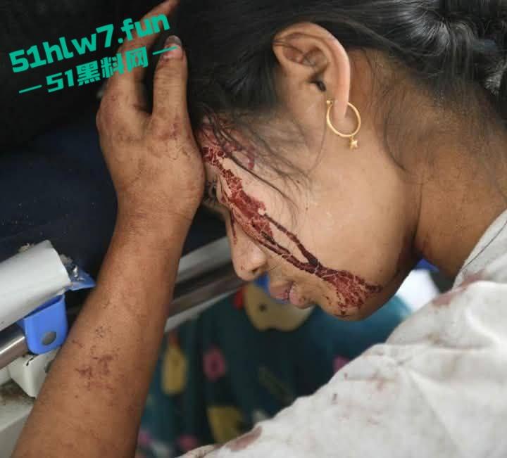 缅甸7.7级震后中国救援队紧急出手仍有众多受难者被压,高温湿臭蚁虫霍乱惨如地狱。-7