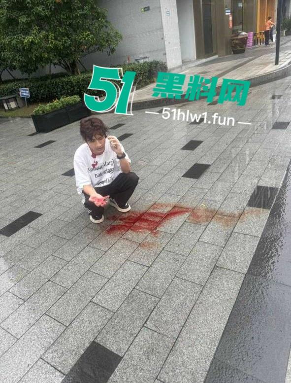 杭州男模【江江】自称网络乞丐,讹上谁就不放过不断纠缠,最终遭人暗算暴打脑袋开瓢。-10