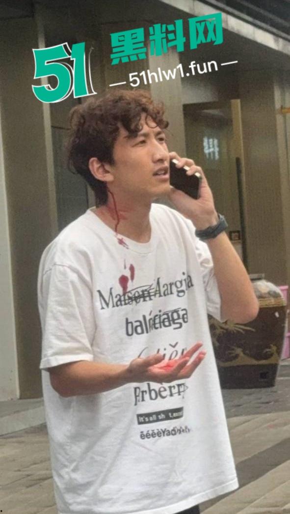 杭州男模【江江】自称网络乞丐,讹上谁就不放过不断纠缠,最终遭人暗算暴打脑袋开瓢。-11